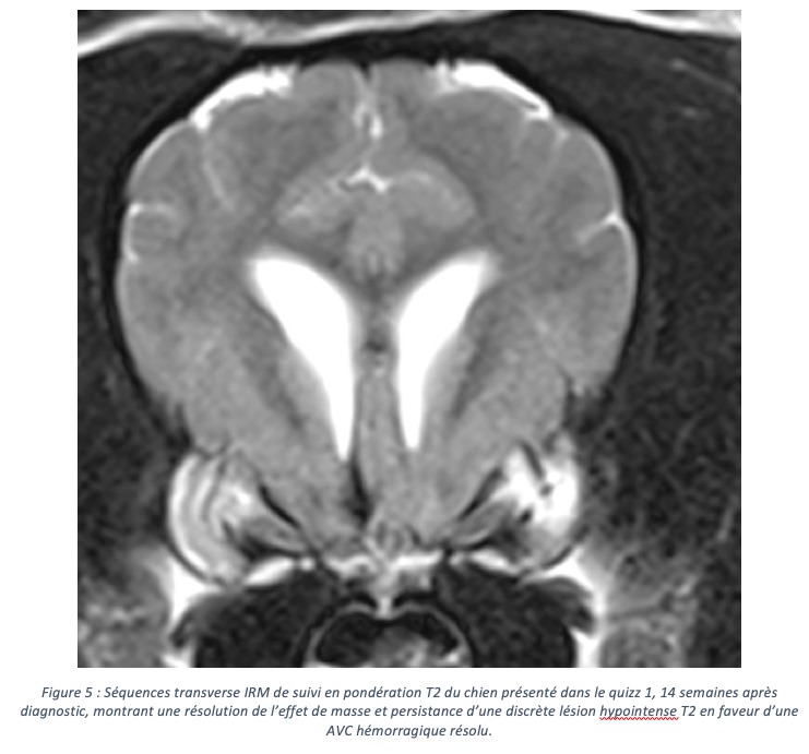Savoir différencier un AVC d’une tumeur à l’imagerie